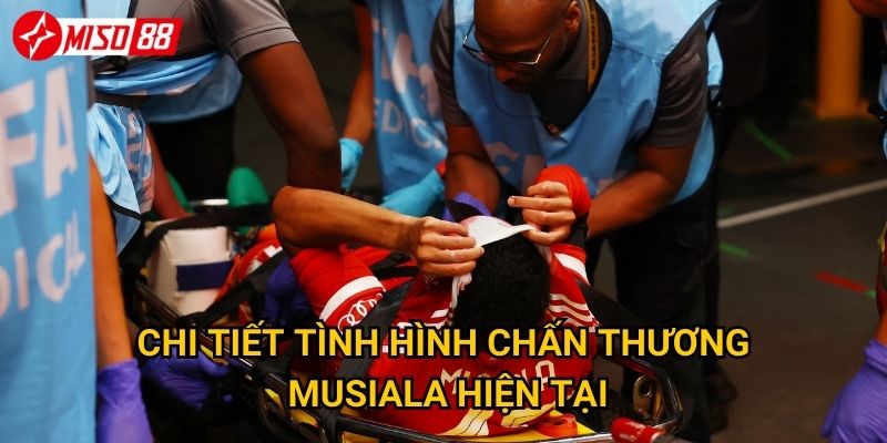 Musiala chấn thương nặng: Miso88 dự đoán Bayern có khủng hoảng không? 2 Chi tiết tình hình chấn thương Musiala hiện tại