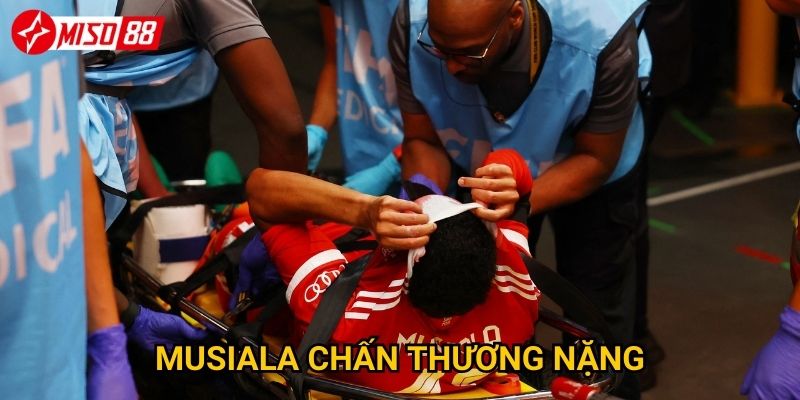 Musiala chấn thương nặng: Miso88 dự đoán Bayern có khủng hoảng không? 1 Musiala chấn thương nặng: Miso88 dự đoán Bayern có khủng hoảng không?